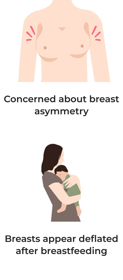 Concerned about breast asymmetry, breasts appear deflated after breastfeeding