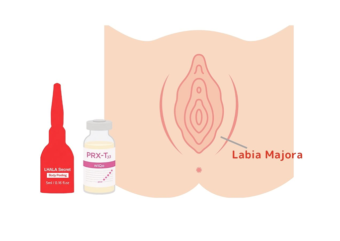 What is Intimate Area Chemical Peel?