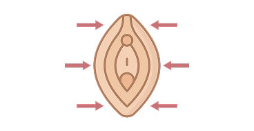 Noticing a loss of volume in the labia majora