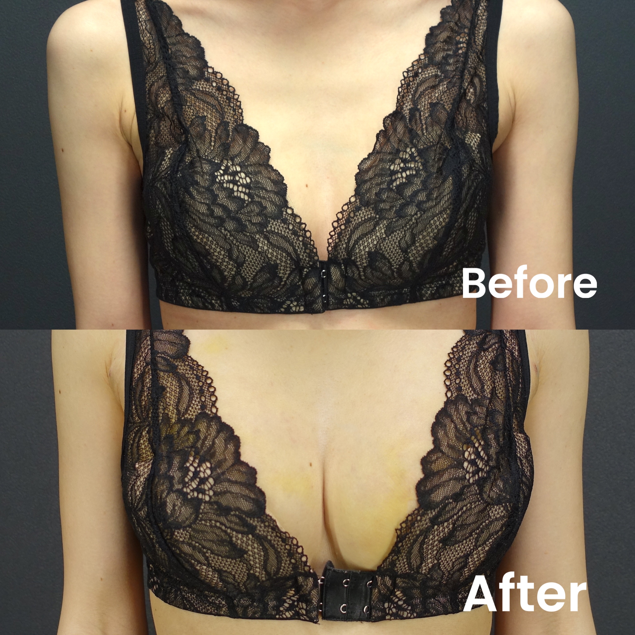 Boost Your Bust