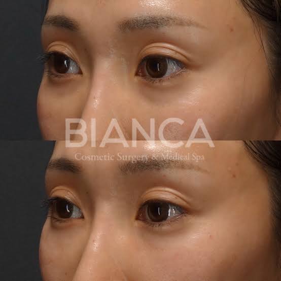 Baby Collagen
