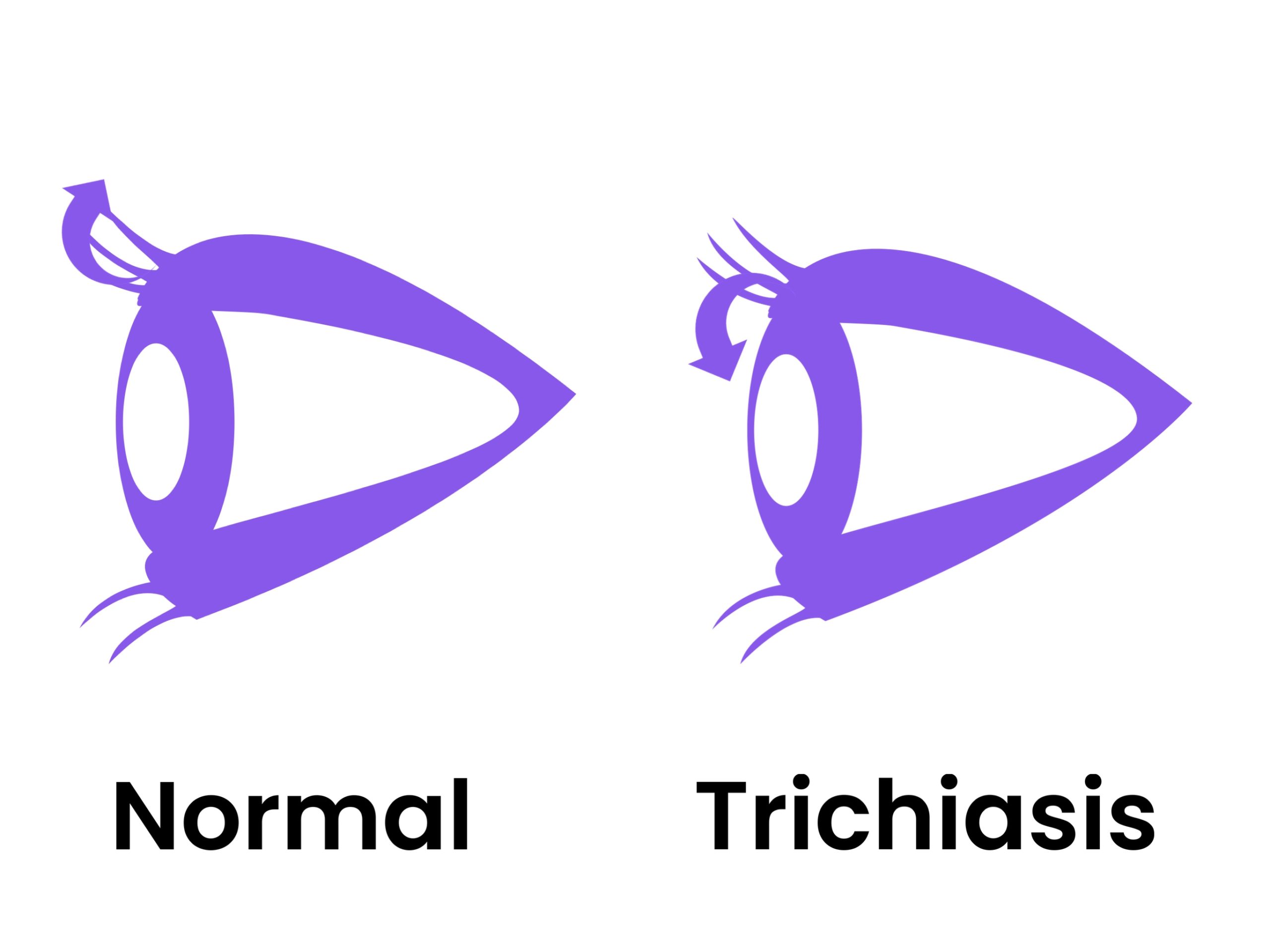 Itchy eyelashes