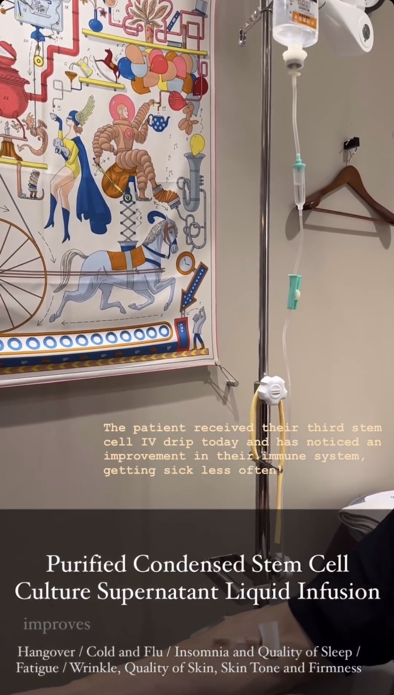 stem cell therapy