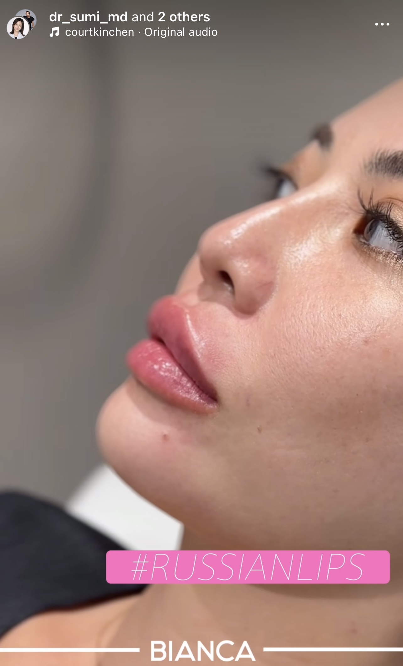Russian Lips