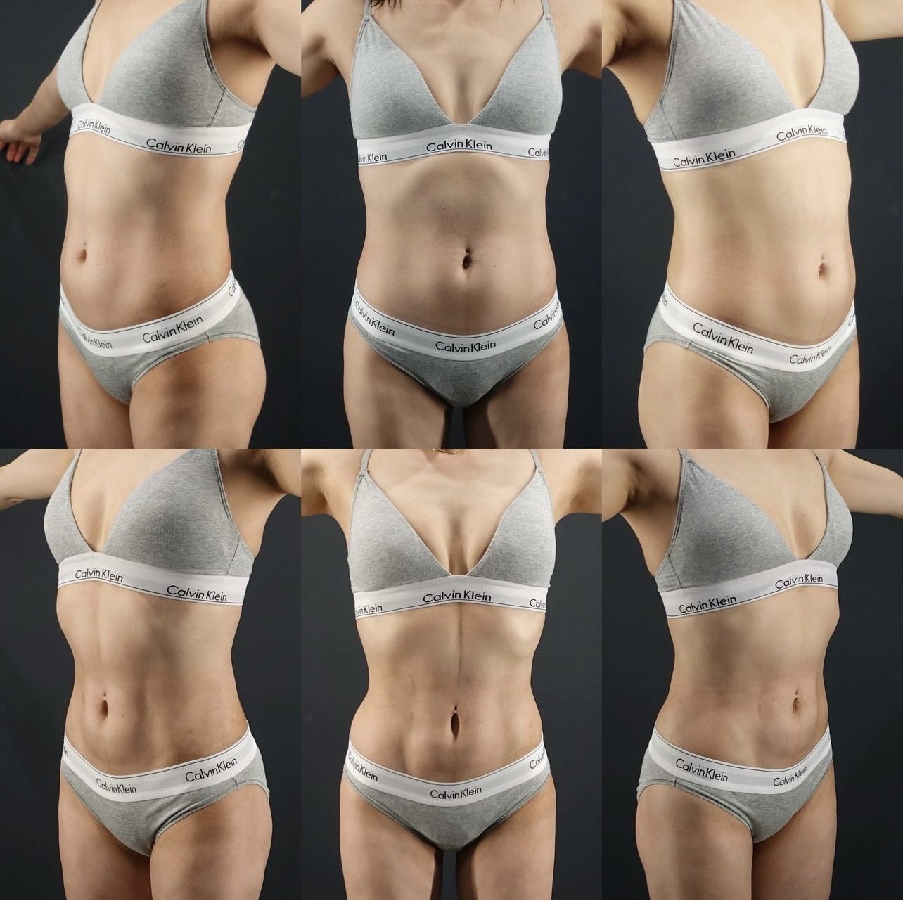 Abcracks ( Abdominal Etching) BIANCA in Tokyo, Japan