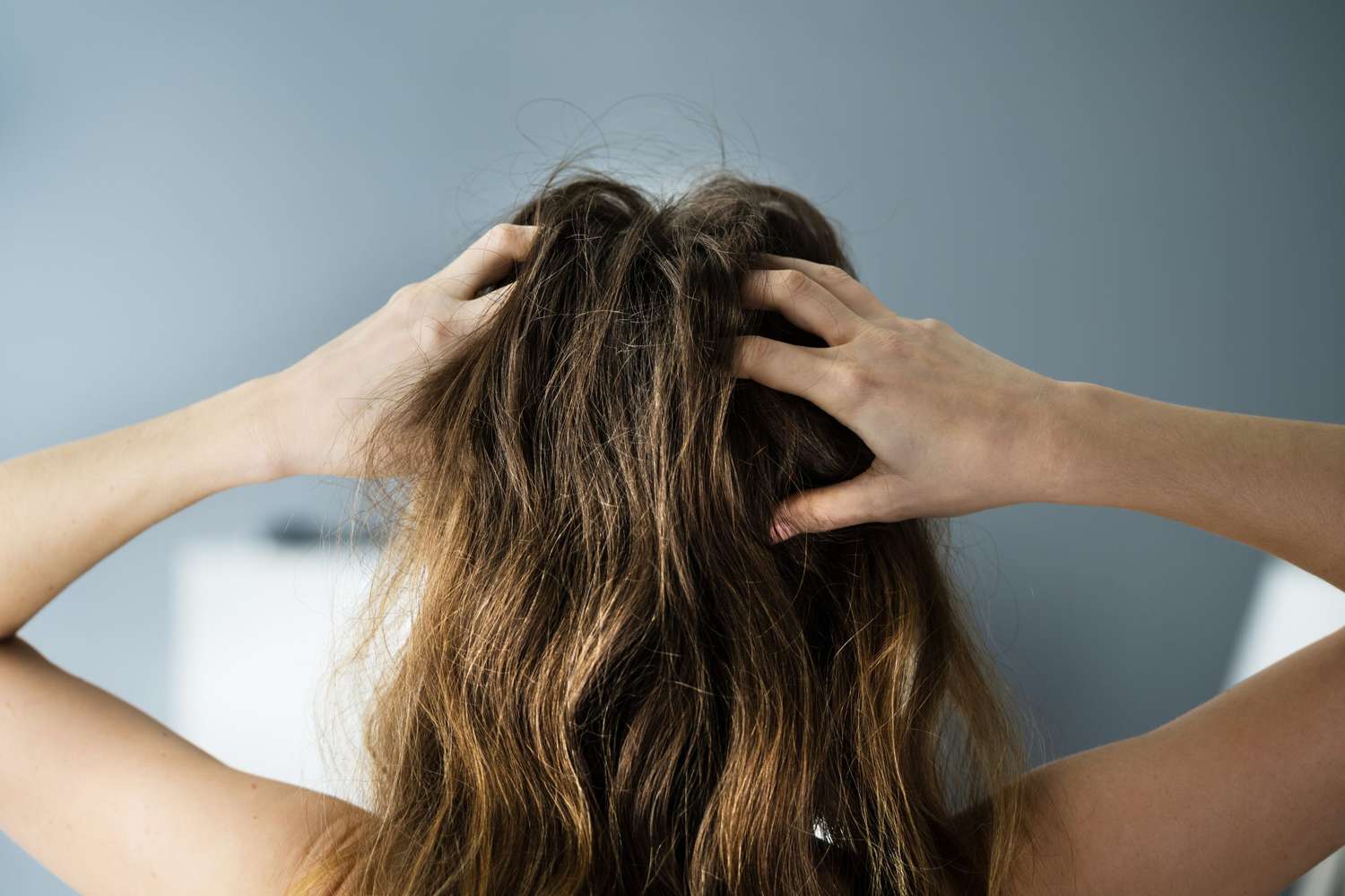 The Relationship Between Hair Loss and Female Hormones: Progesterone’s Role