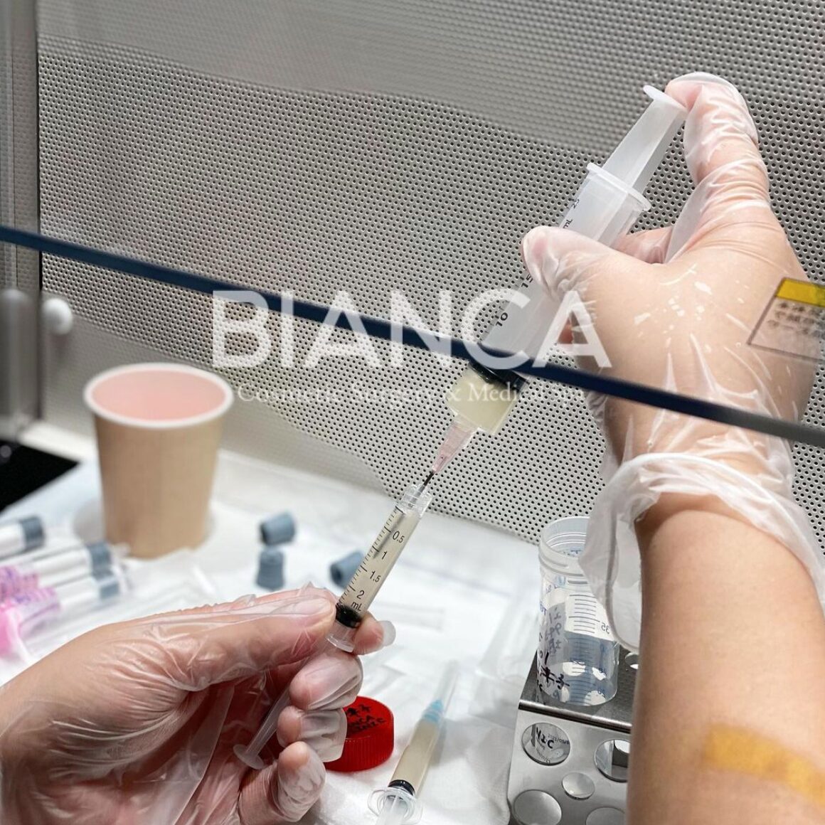 Dermal Fibroblast Therapy｜BIANCA in Tokyo, Japan