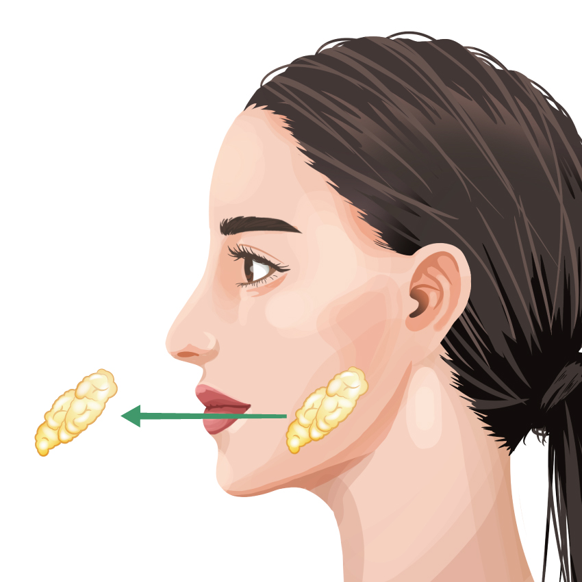 Buccal Fat Removal BIANCA in Tokyo, Japan