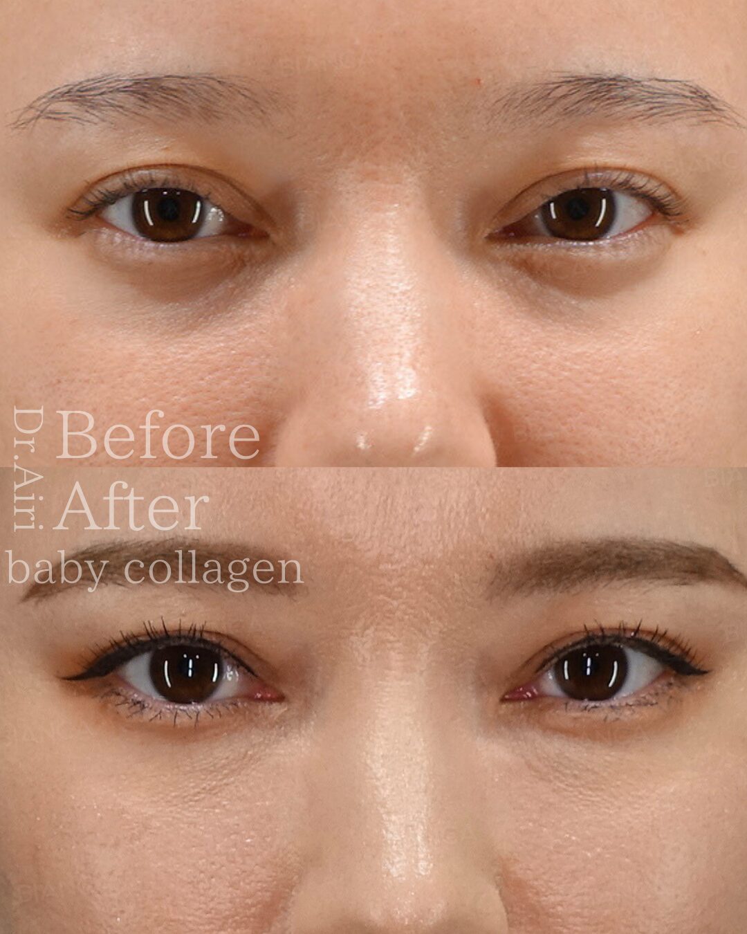 Baby Collagen BIANCA in Tokyo, Japan