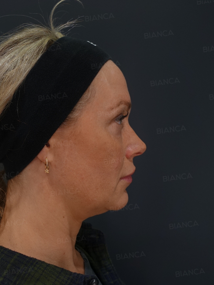 BIANCA in Tokyo, Japan