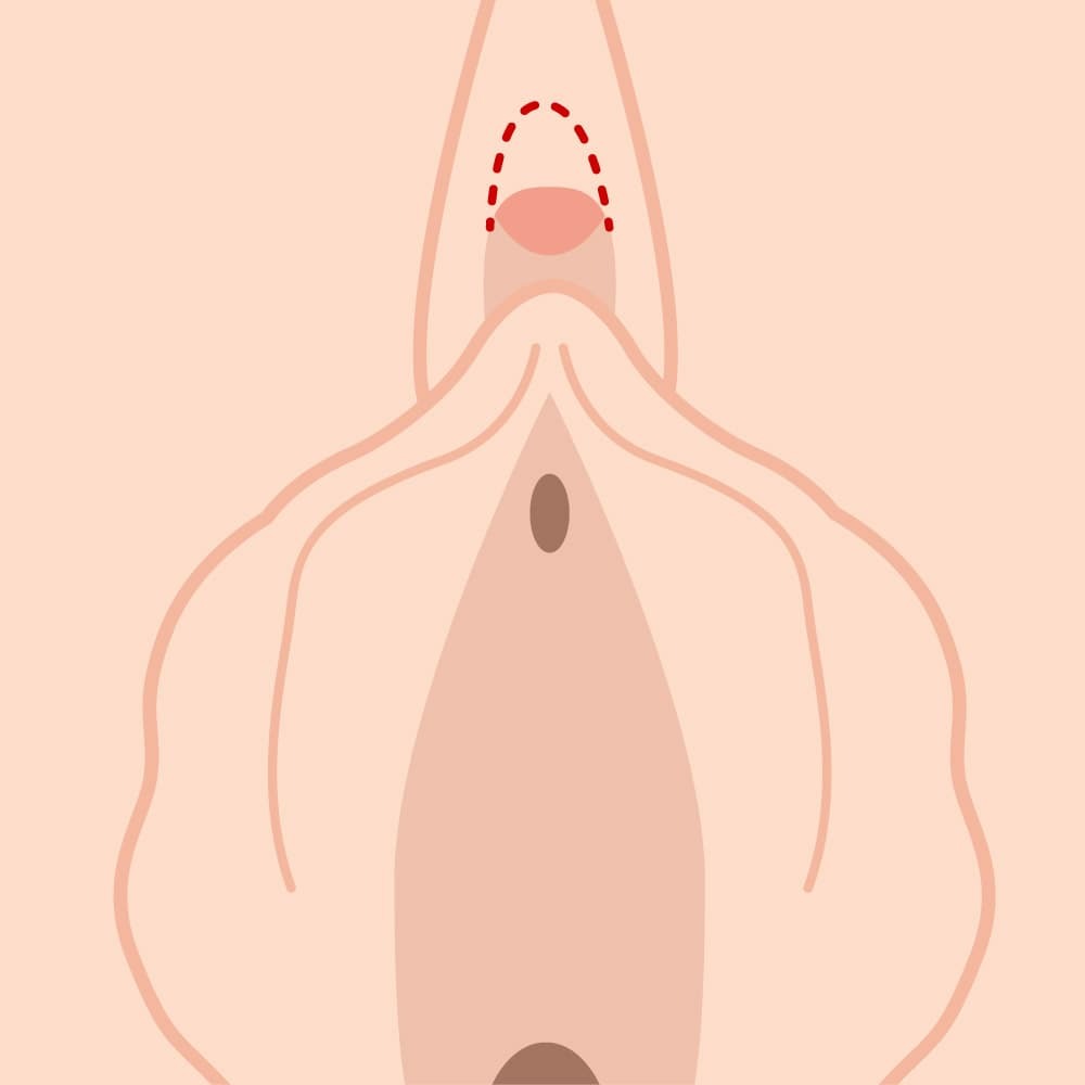 treatment_img