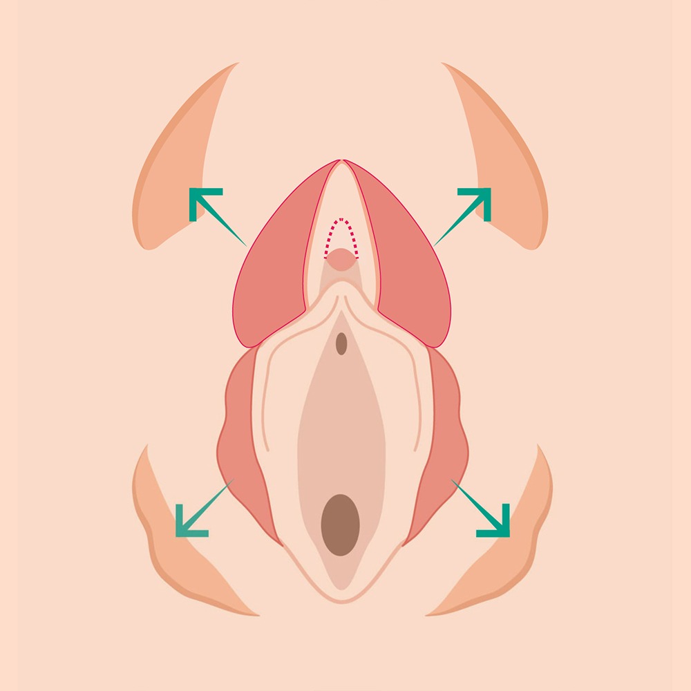 treatment_img