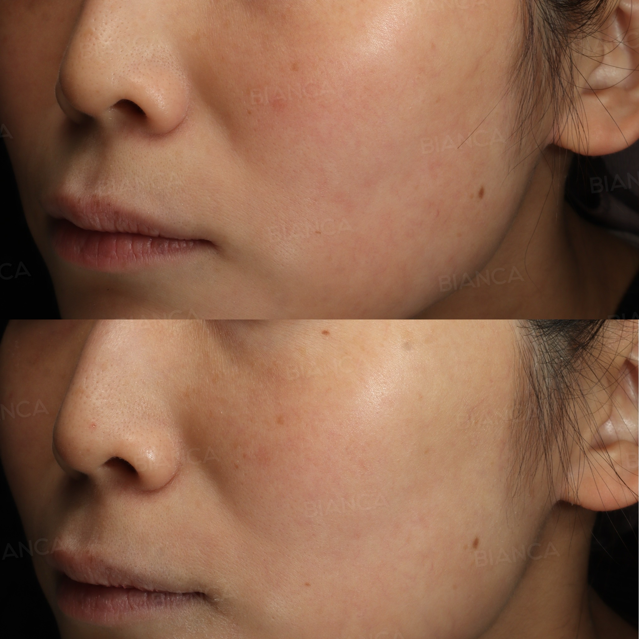 Skin Whitening Treatment in Tokyo: Doctor-Guided Options at a Modern Medical Spa