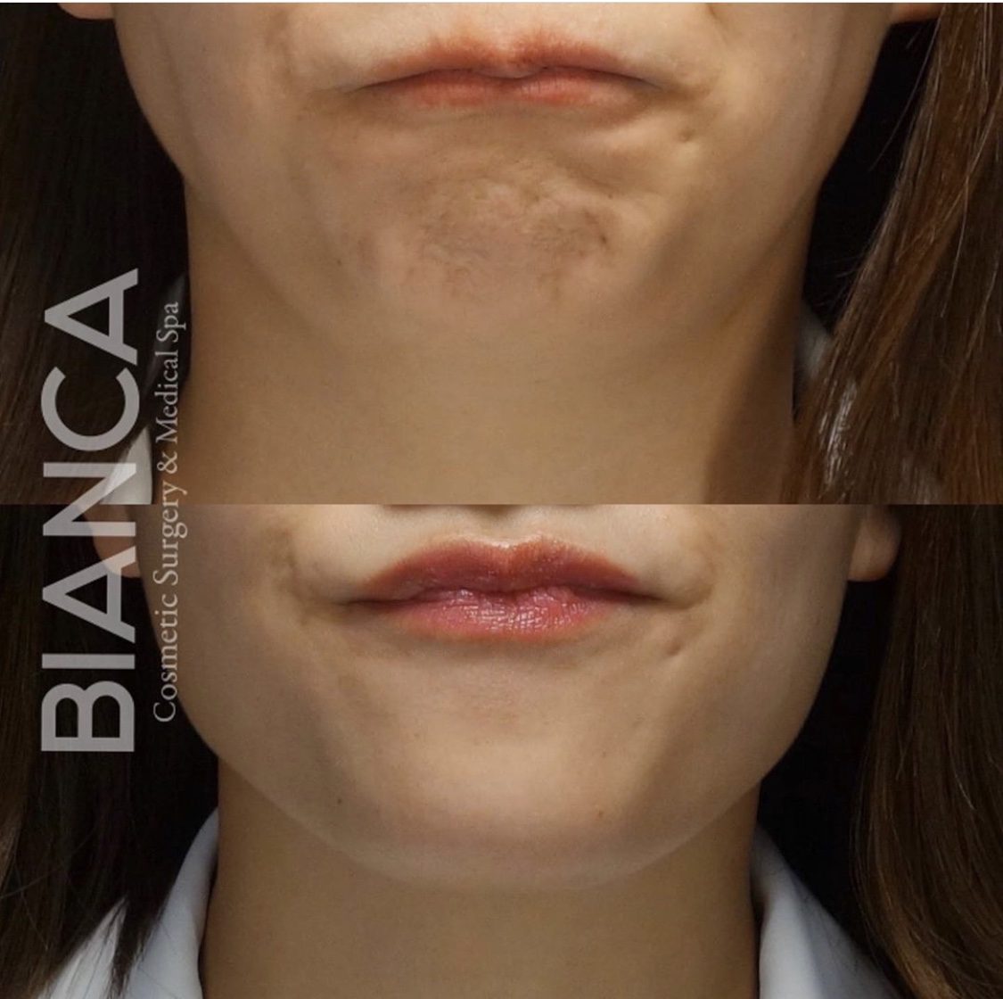 Your Doctor‑Led Guide to botox allergan in Tokyo: Natural Results, Thoughtful Care