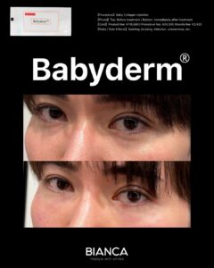 BABYDERM｜Trust BIANCA in Tokyo, Japan tailored to your love handles. love handles BIANCA in Tokyo, Japan