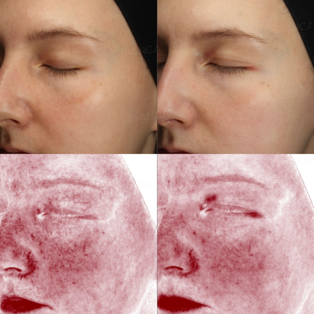 Medical Spa Laser Treatment in Tokyo: Hair Removal, Texture and Laxity Issues