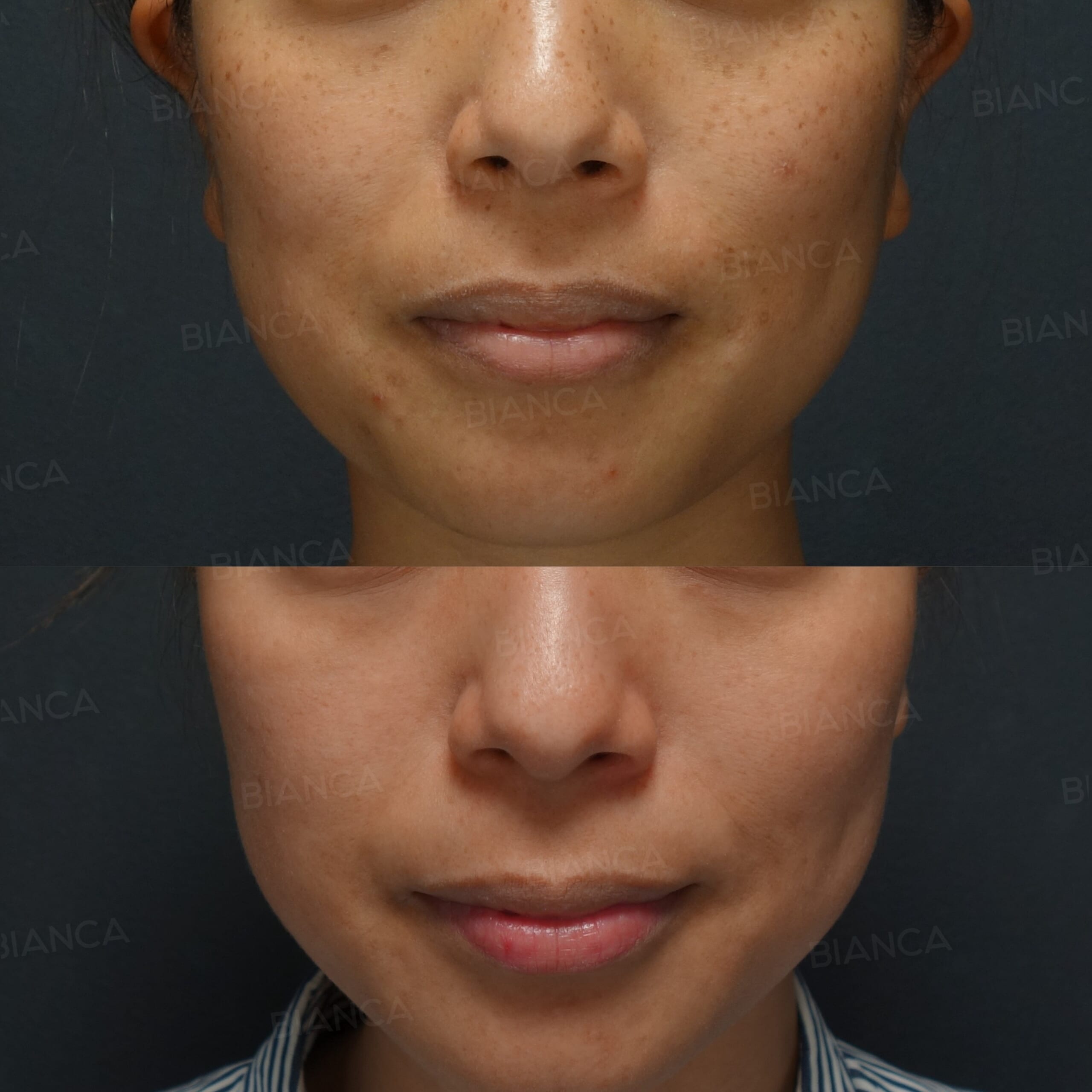 Strawberry Skin Treatment: The Fantastic News Everyone’s Been Waiting for in Tokyo