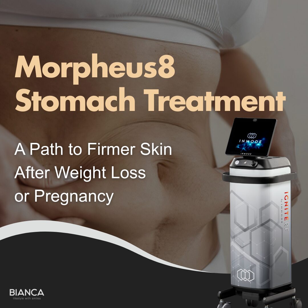 morpheus8 stomach｜Trust BIANCA in Tokyo, Japan for Morpheus8 stomach and abdomen skin tightening. morpheus8 stomach BIANCA in Tokyo, Japan