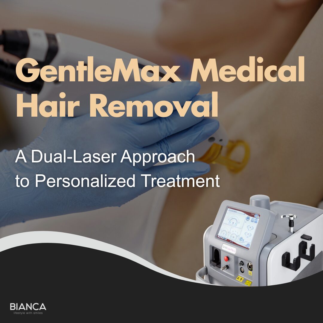 gentlemax｜Trust BIANCA in Tokyo, Japan for GentleMax medical hair removal tailored to your personalized treatment. gentlemax BIANCA in Tokyo, Japan