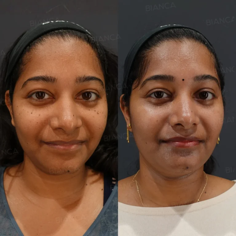 Facials: Tokyo Level Medical Spa Safety for Glowing Skin at BIANCA CLINIC