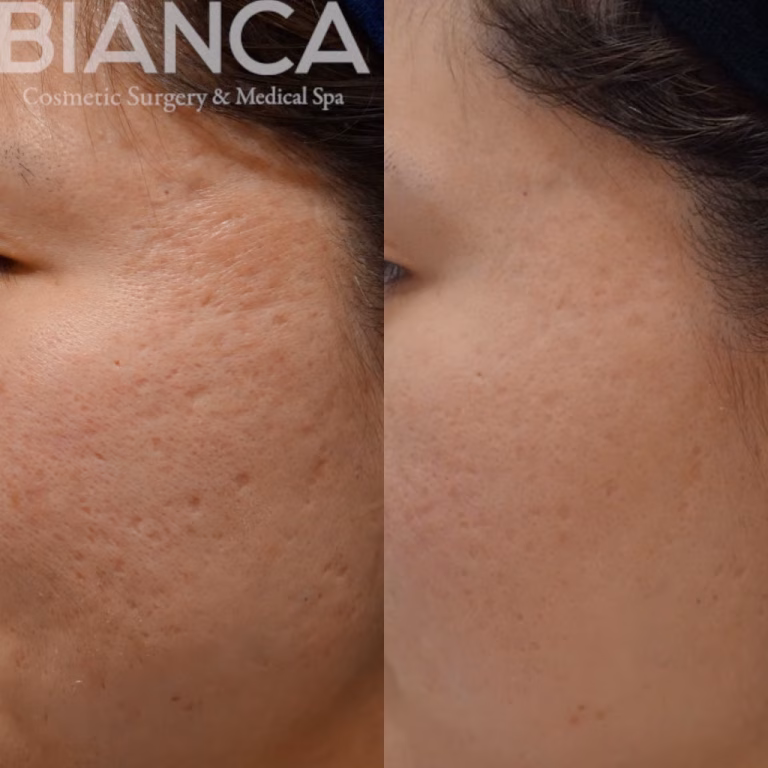 Longevity Healthcare: The Best Anti-Aging Aesthetic Treatments in 2026